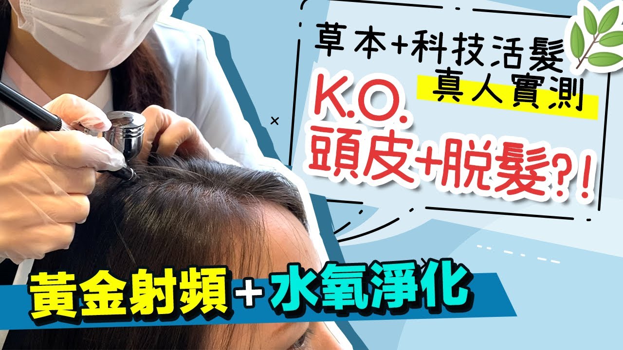 網紅KOLTraveLa 莎朗工作紀錄: 如何改善脫髮？頭皮屑多？髮線後移？頭髮稀疏？